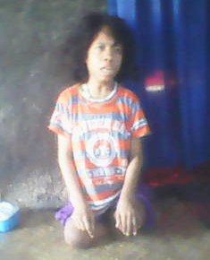 Defita, remaja yang lumpuh,tuli,dan bisu sejak lahir (Ardy Abba/Floresa)