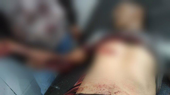 Korban mengalami luka para di bagian tangan dan dada (Foto: Polisi)